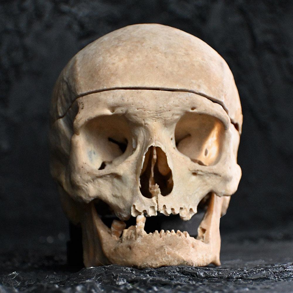 19th century Medical Human Skull Example 
A fine example of 19th Century medical school human skull, in three sections and not hinged. A deep natural patination, which has taken a lifetime to grow. 

Size in inches: H 8” x W 6” x D 9” 
Age: 19th