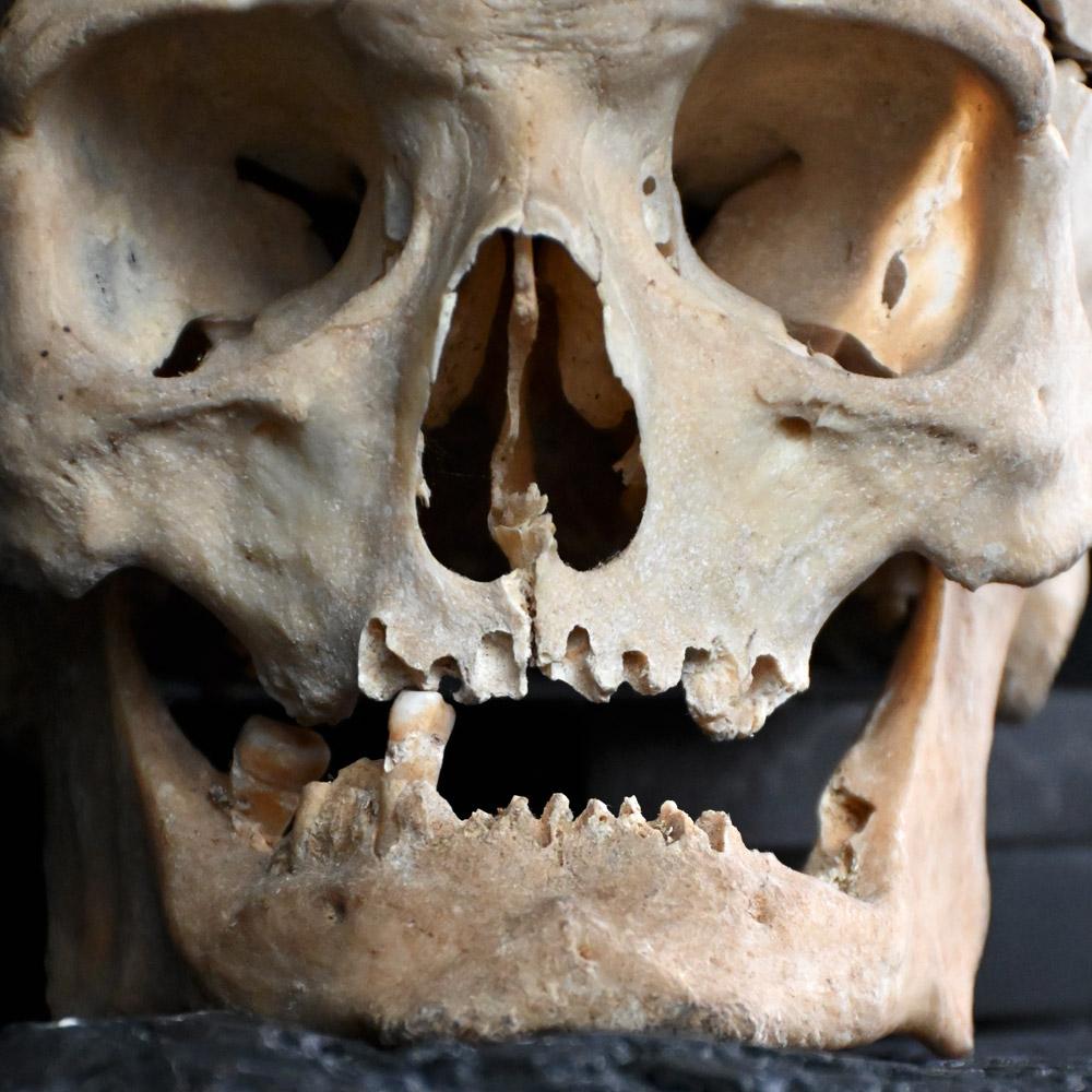 antique human skull