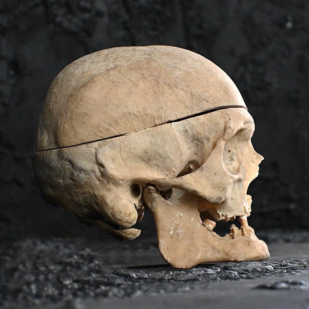 real skull