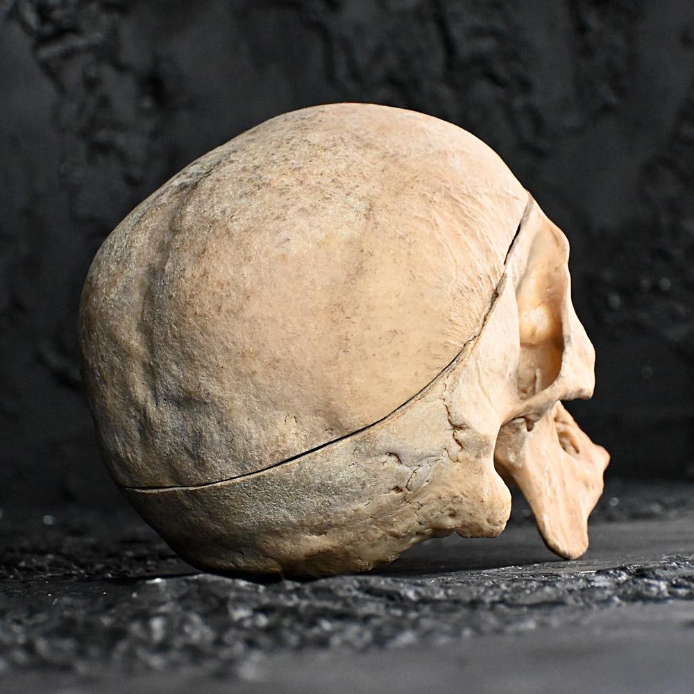 Early Victorian 19th Century Medical Human Skull Example