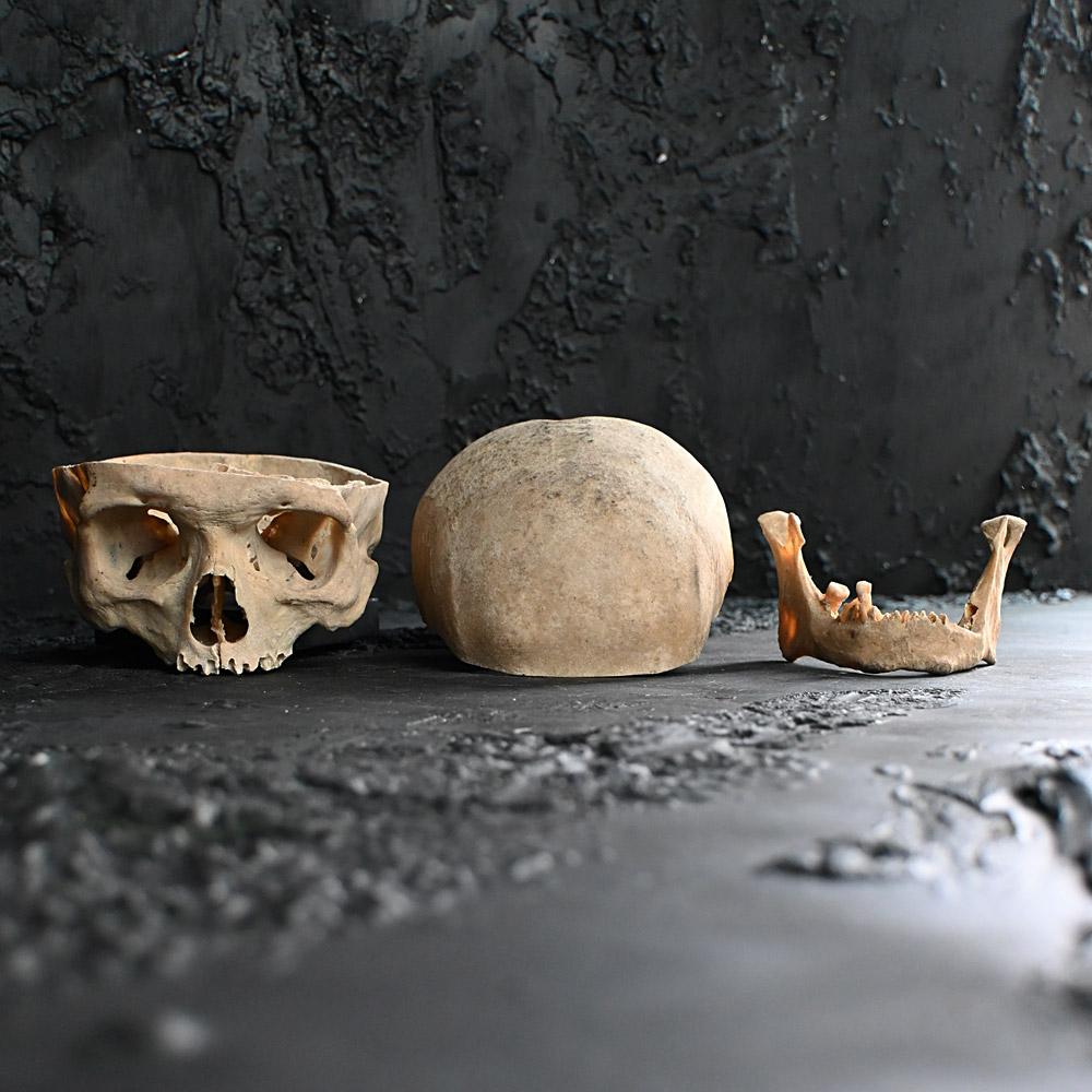 Unknown 19th Century Medical Human Skull Example