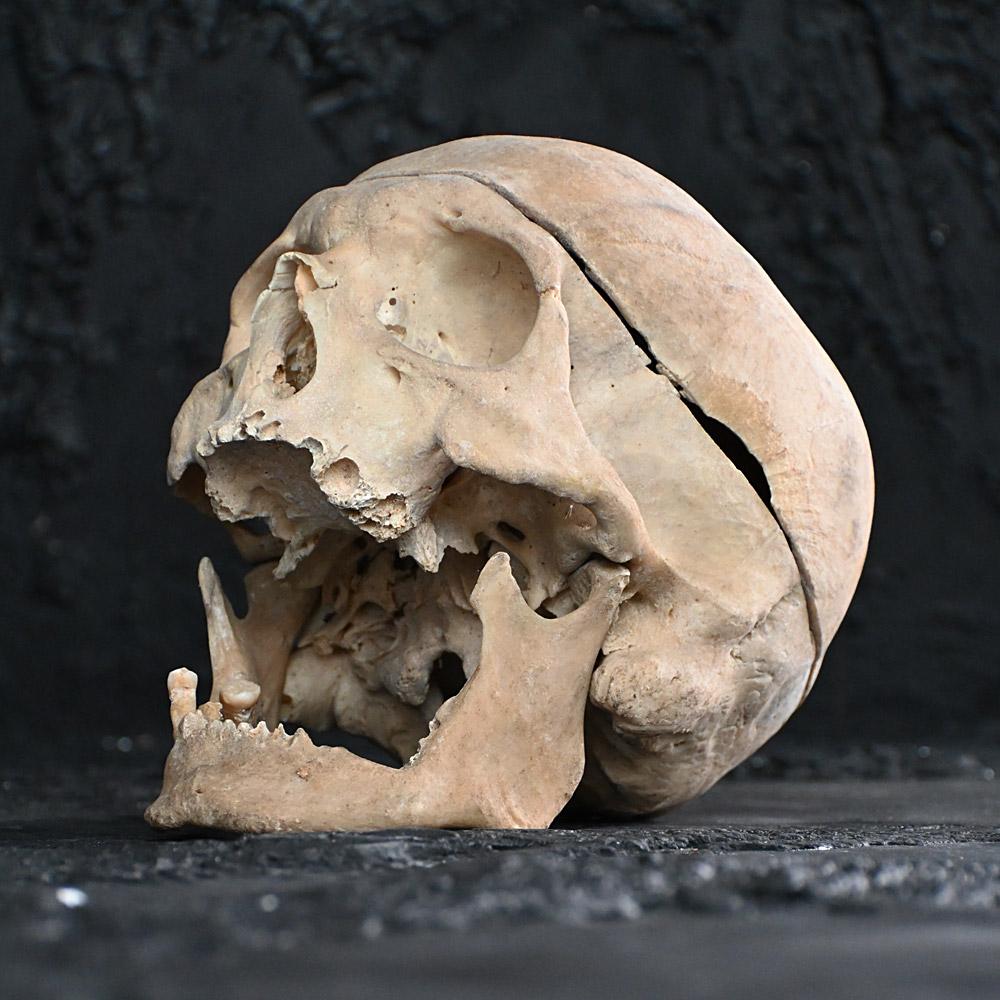 Hand-Crafted 19th Century Medical Human Skull Example