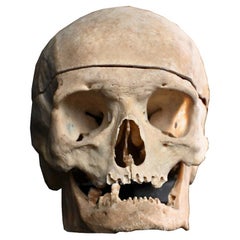 19th Century Medical Human Skull Example