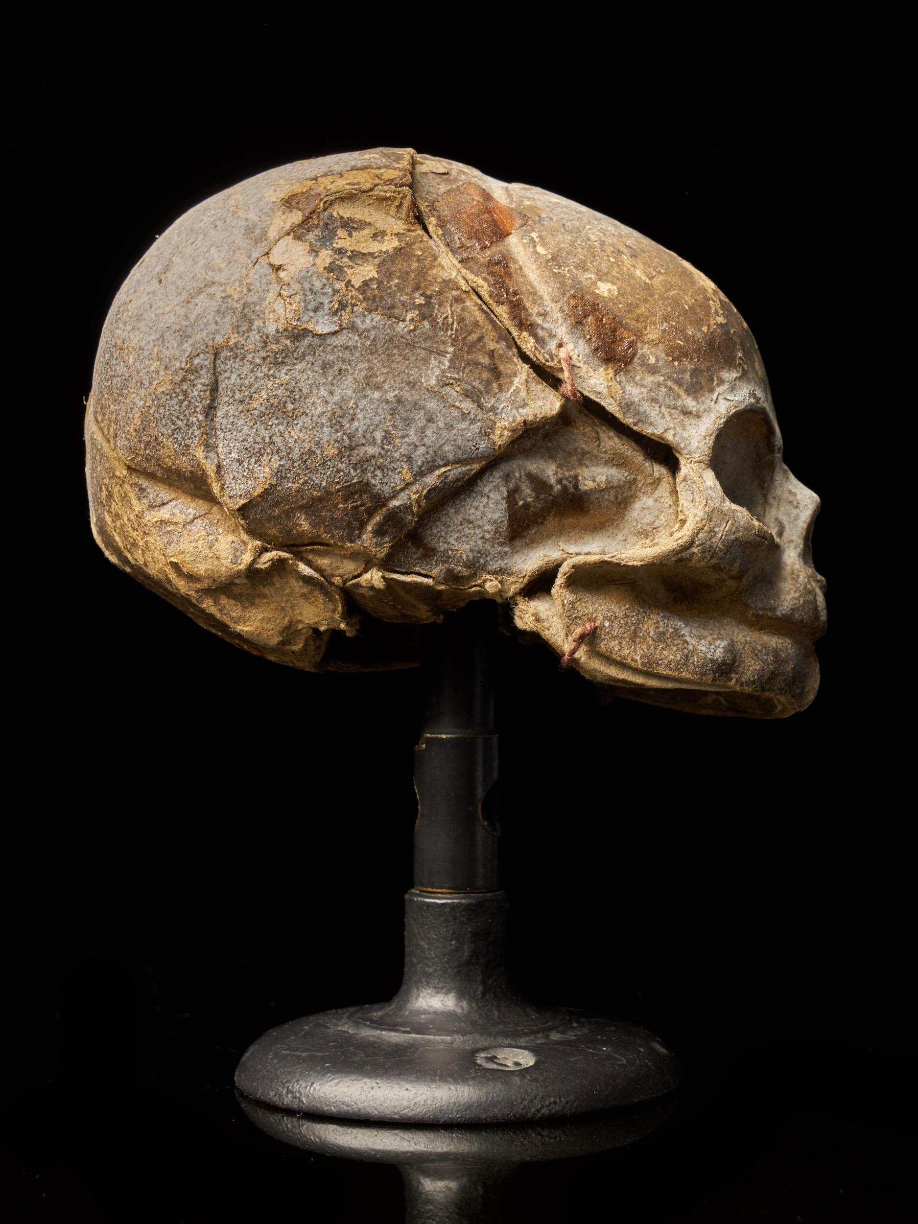 French 19th Century Papier-Mâché Fetal Skull