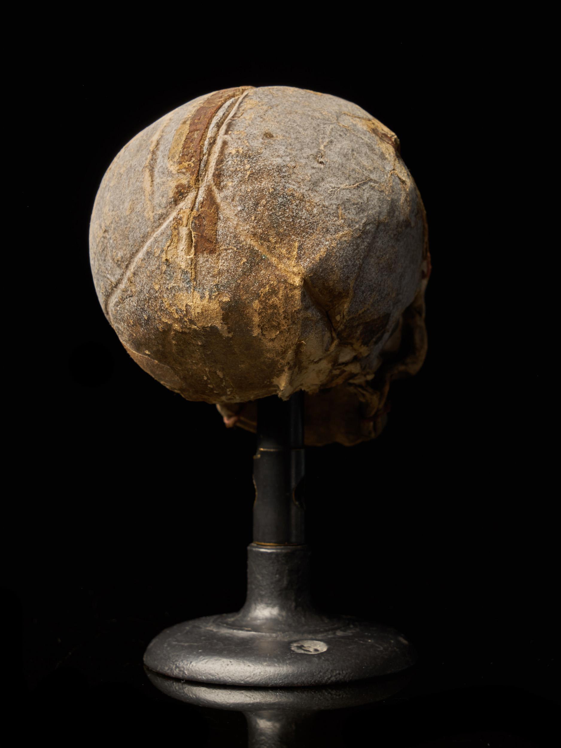 Hand-Crafted 19th Century Papier-Mâché Fetal Skull