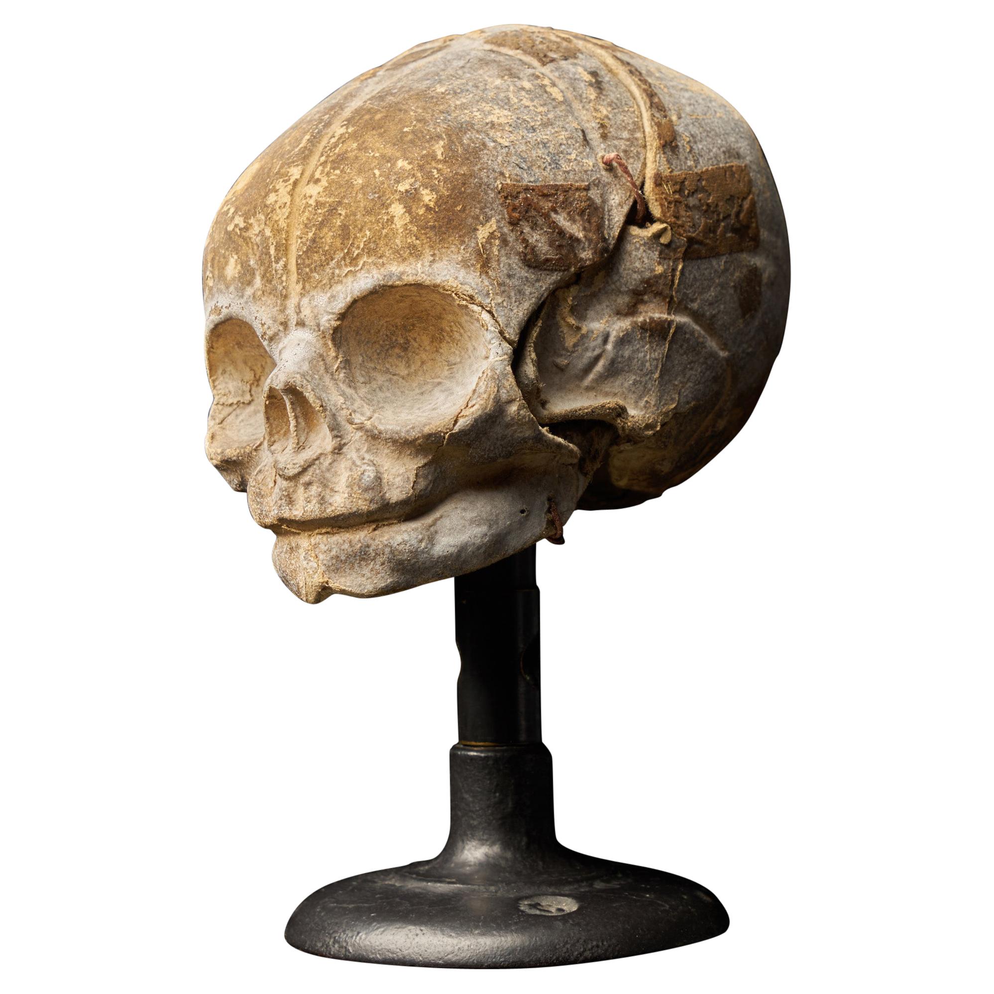 19th Century Papier-Mâché Fetal Skull
