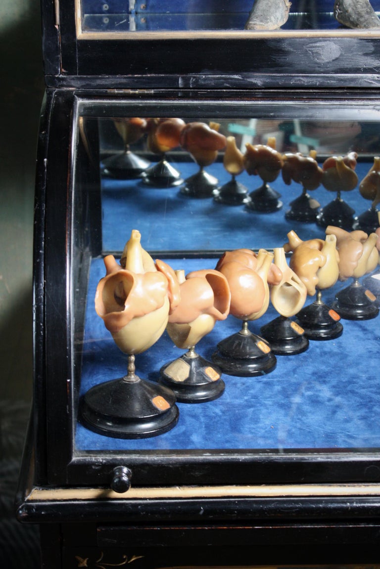 19th C Wax Anatomical Models Human Heart Growth Scientific Medical F