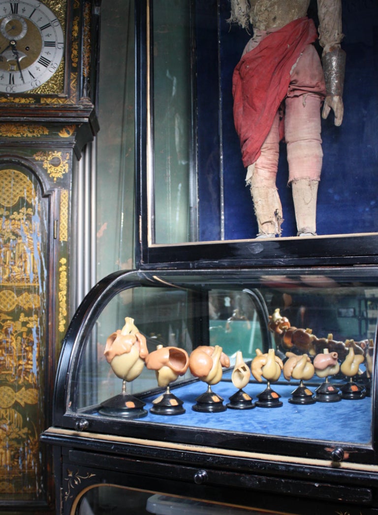 19th C Wax Anatomical Models Human Heart Growth Scientific Medical F