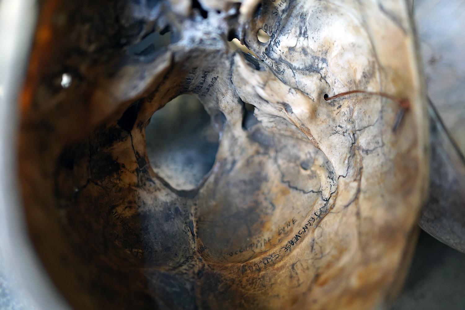 19thC Human Skull Inscribed for Phrenological Demonstration For Sale 4
