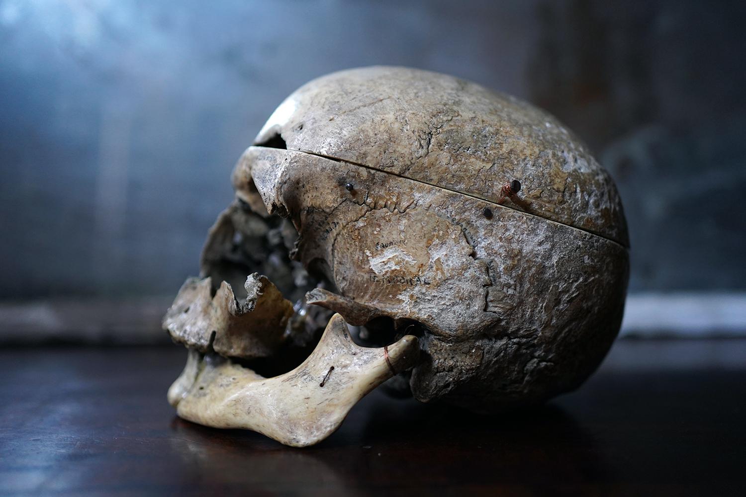 The largely in-tact human skull, dating to the late nineteenth to early twentieth centuries, having been used for medical study or phrenological demonstration and inscribed in both in English and Latin in the early part of the twentieth century in