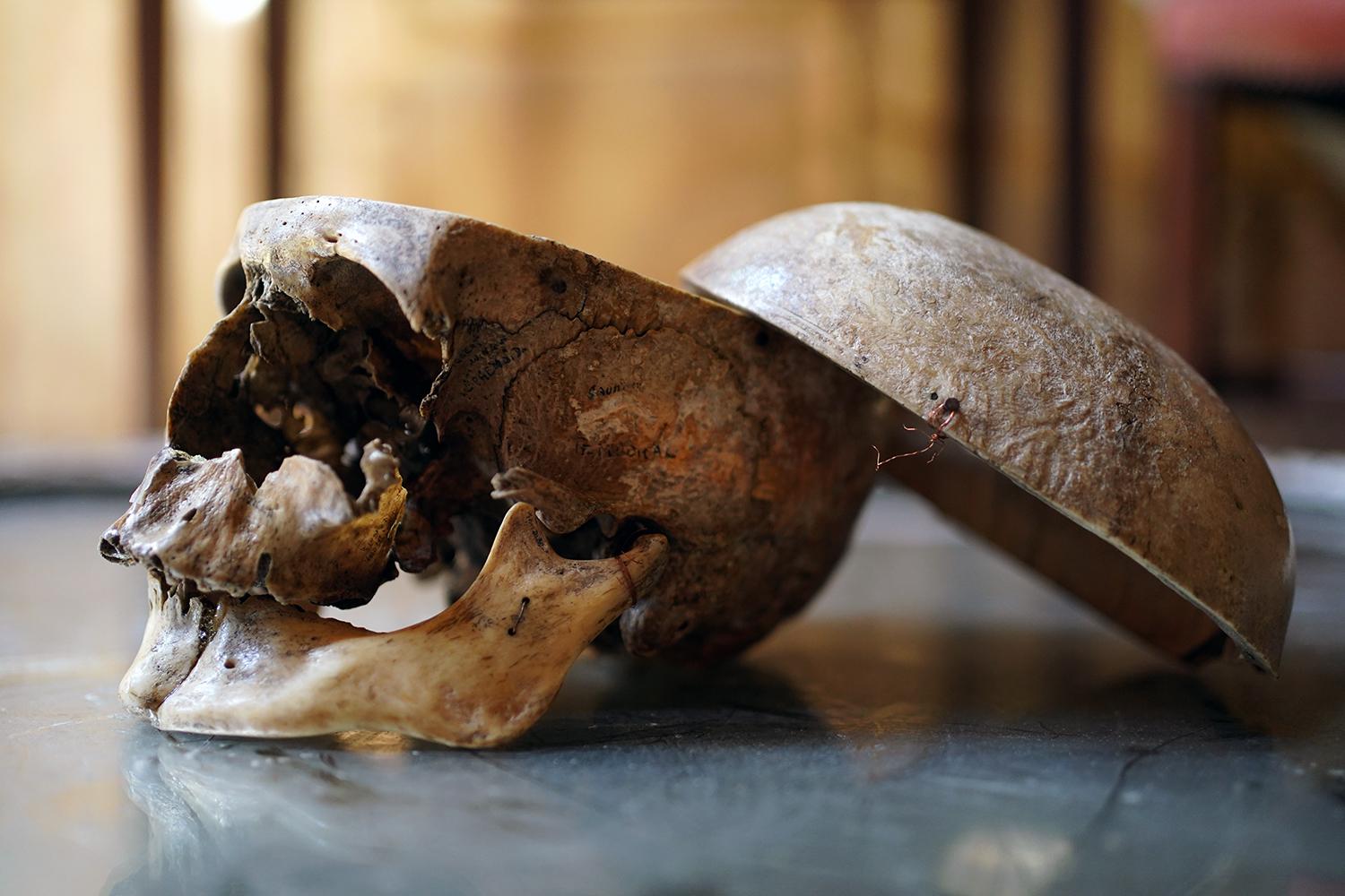 19thC Human Skull Inscribed for Phrenological Demonstration For Sale 2