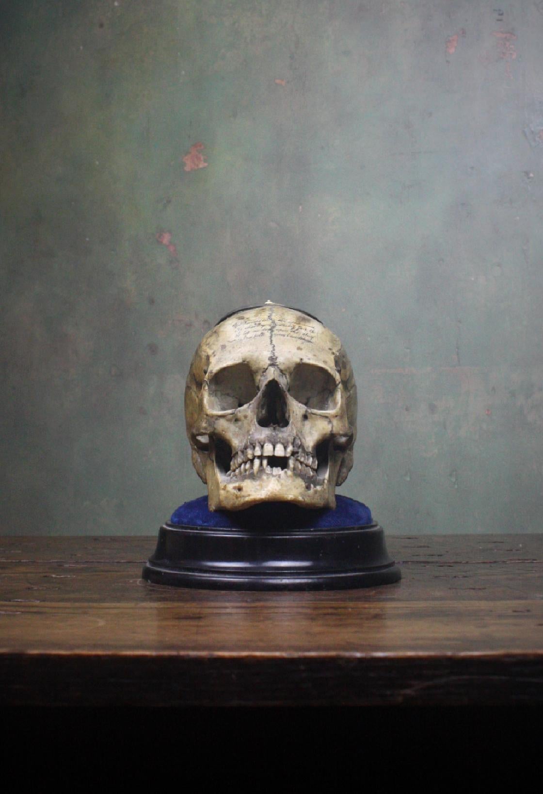 19th Century Memento Mori Human Skull Bone Tobacco Jar with Rhyme Masonic Freeman's