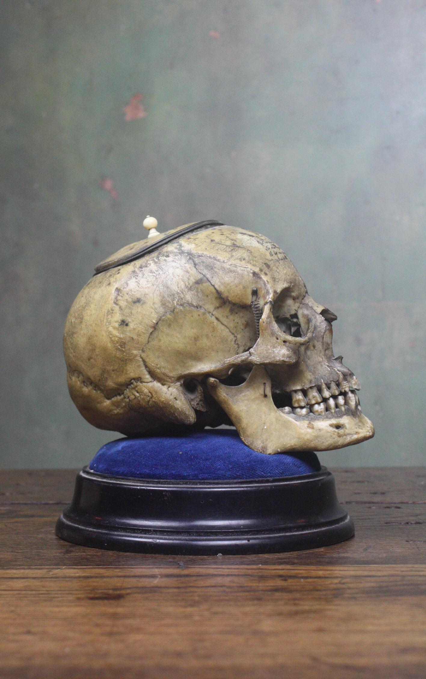 Memento Mori Human Skull Bone Tobacco Jar with Rhyme Masonic Freeman's In Good Condition In Lowestoft, GB