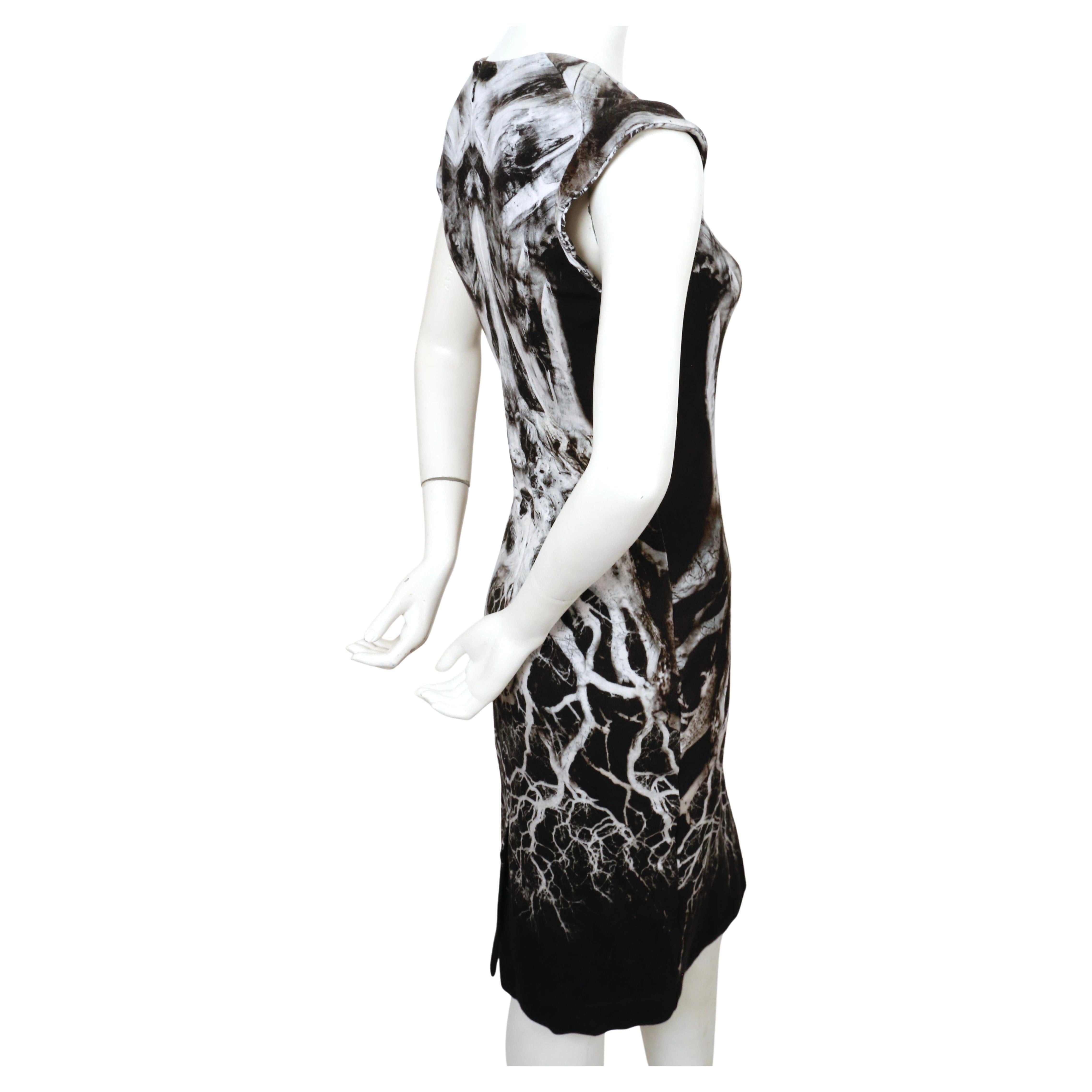 Black 2010 ALEXANDER MCQUEEN skeleton print dress  