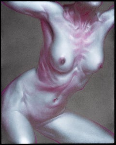 Figura 4