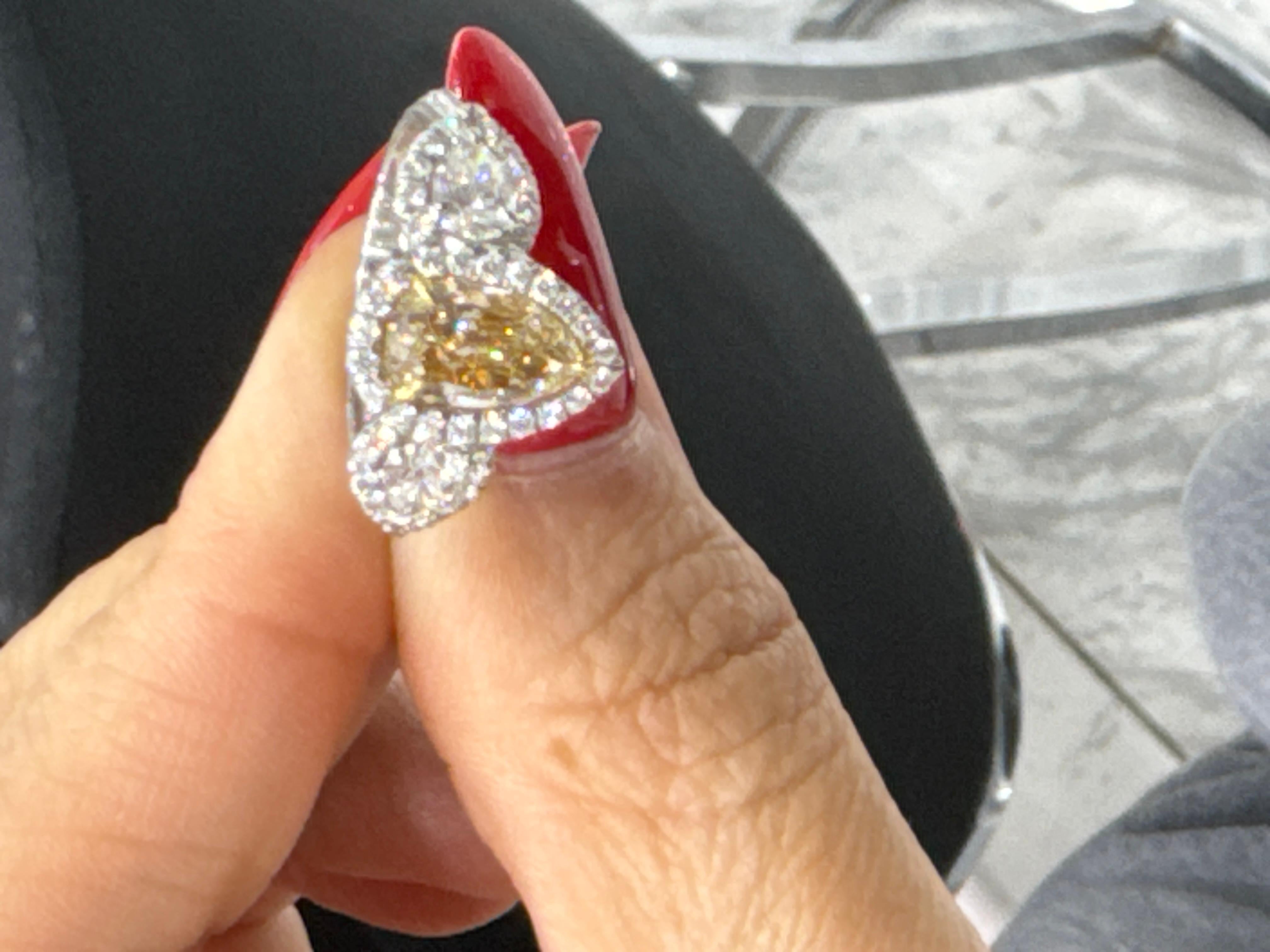25000 engagement ring