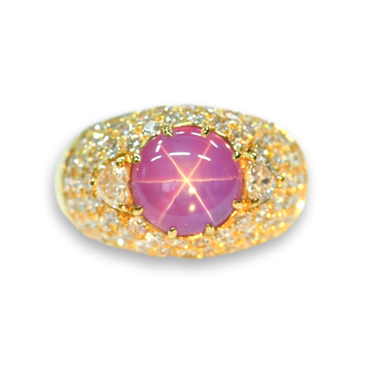 A beautiful pink star sapphire and diamond ring set to center with a very sharp oval cabochon pink sapphire that are surrounded by a plethora of small diamonds and two heart-shaped diamonds. It looks wonderful on the finger and would make a stunning