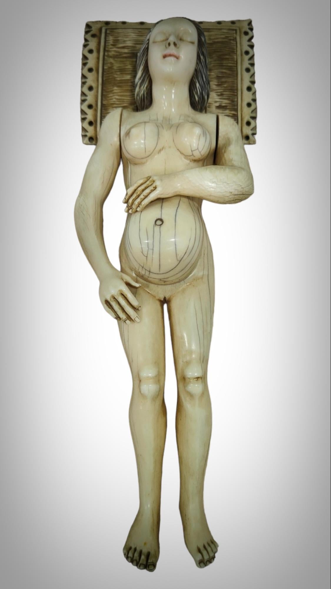 A GERMAN  ANATOMICAL MODEL OF a PREGNANT WOMAN STEPHEN ZICK In Good Condition For Sale In Madrid, ES