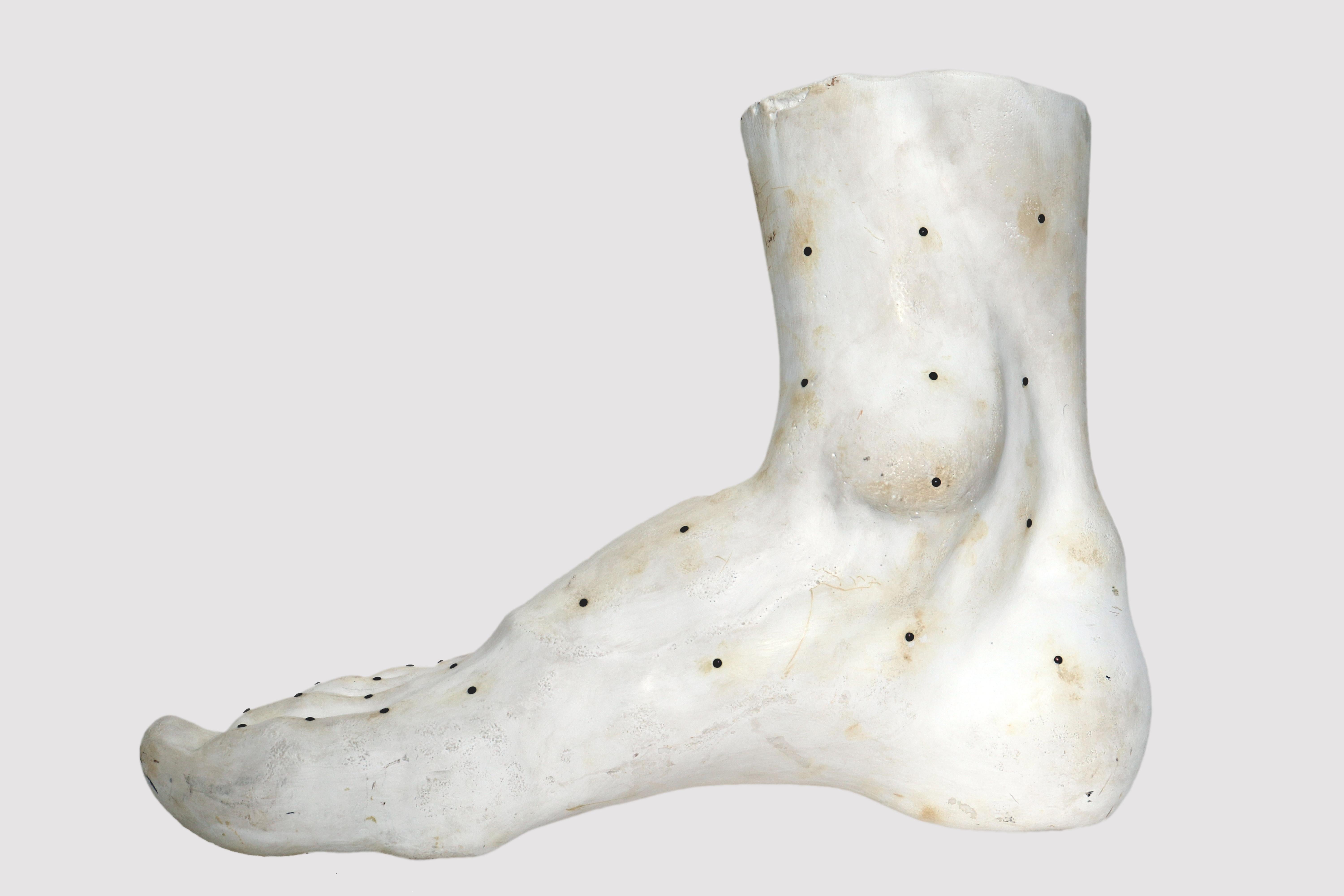 foot plaster