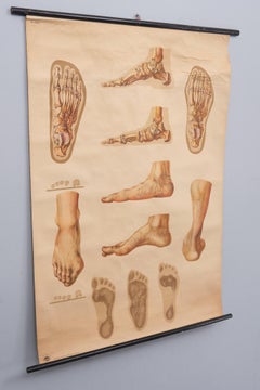 A vintage pull-down medical wall chart illustrating "Orthopedics of Foot" 1930s