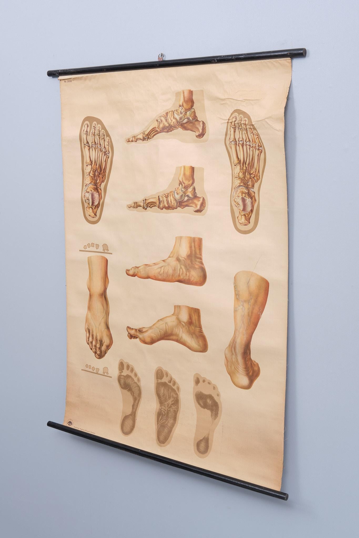 Bauhaus Un tableau mural médical vintage retravaillant illustrant « Orthopedics of Foot » des années 1930  en vente