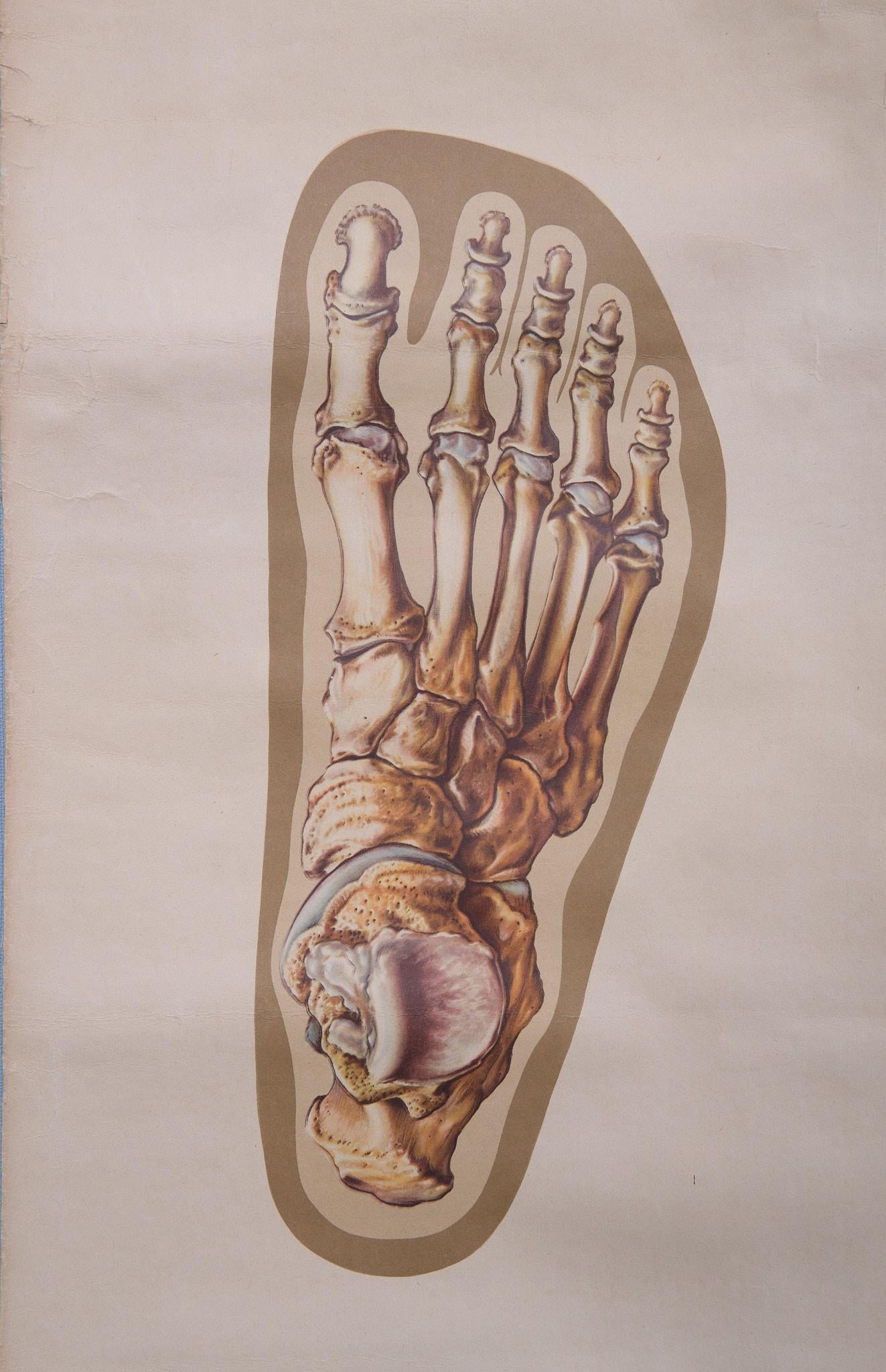 Milieu du XXe siècle Un tableau mural médical vintage retravaillant illustrant « Orthopedics of Foot » des années 1930  en vente