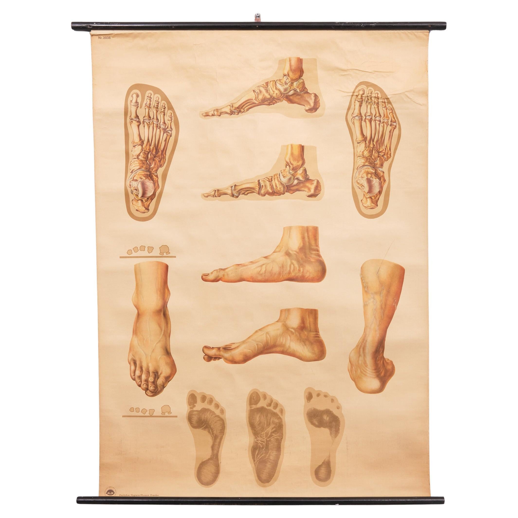 A vintage pull-down medical wall chart illustrating "Orthopedics of Foot" 1930s 