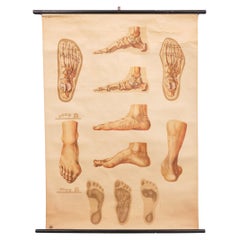 A vintage pull-down medical wall chart illustrating "Orthopedics of Foot" 1930s 