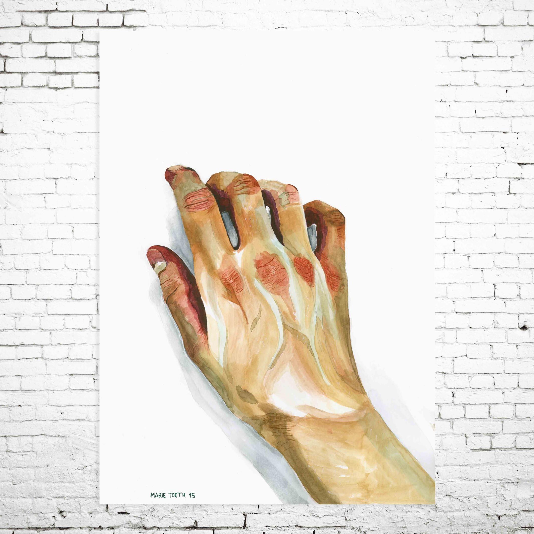Agoraphobia - Print, Watercolor, Hyperrealism, Contemporary, Art, Marie Tooth For Sale 1