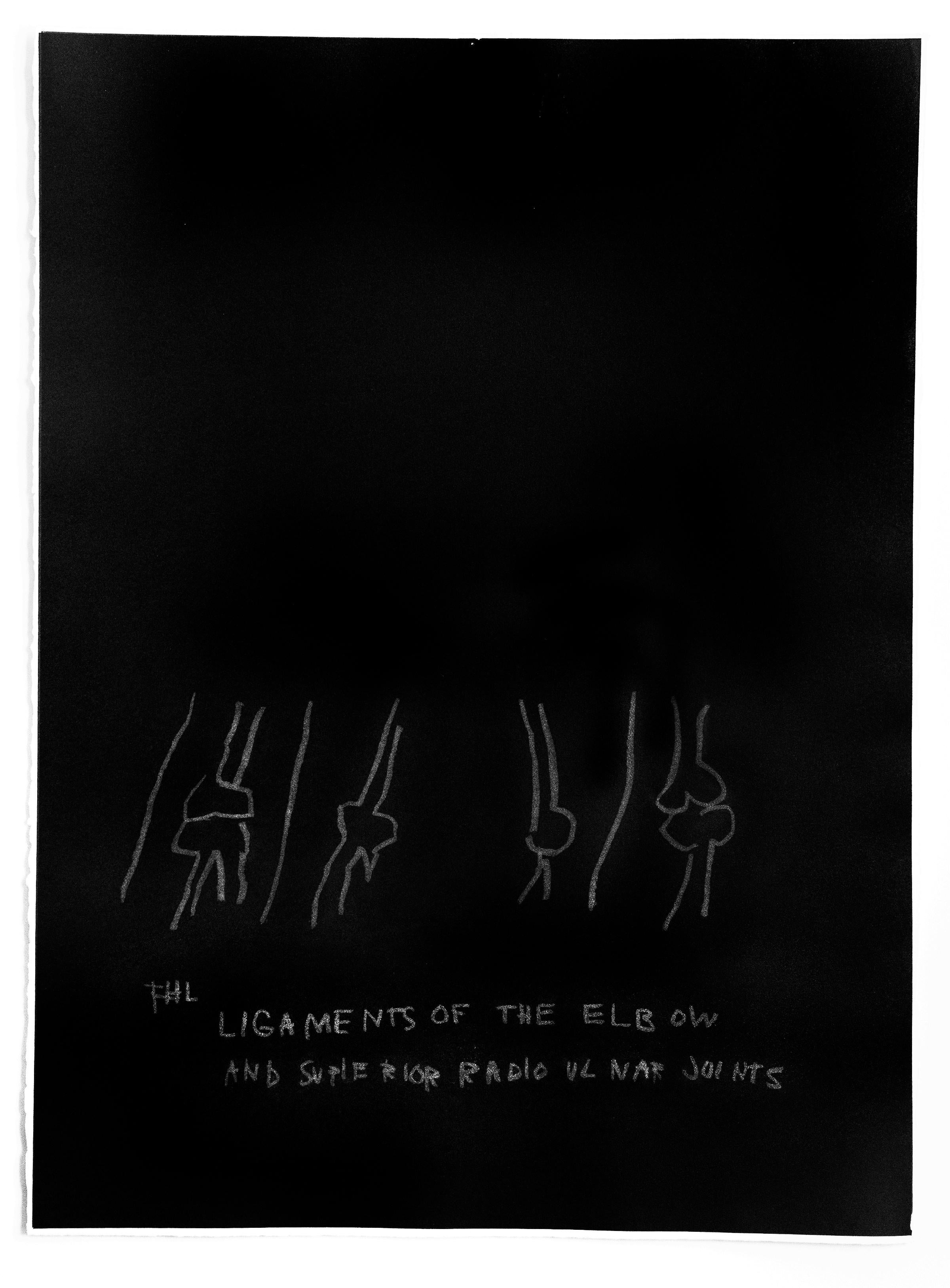 Jean-Michel Basquiat Print - "Ligaments of the Elbow" plate from the Anatomy Series"
