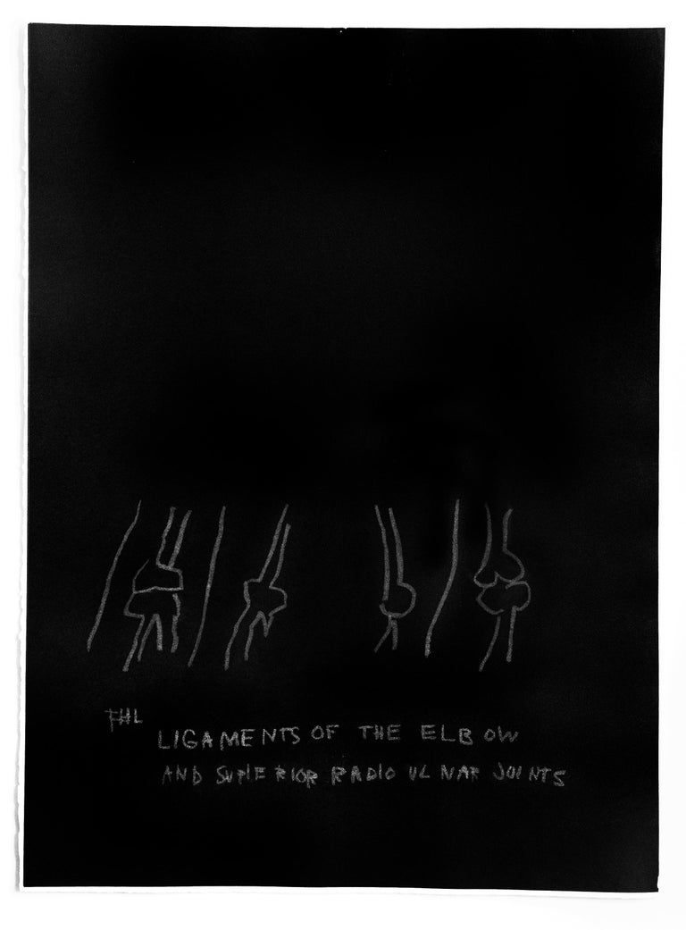 Jean Michel Basquiat Print - "Ligaments of the Elbow" plate from the Anatomy Series"