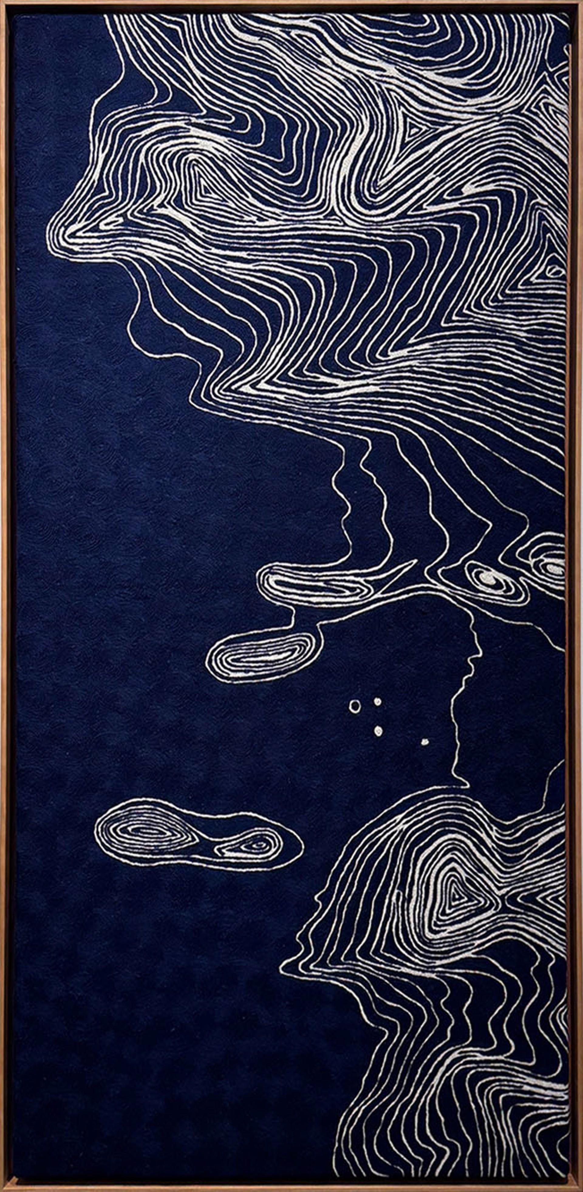 Topozure