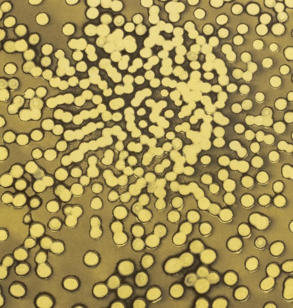 Ross Bleckner „Selection Sequence“ Radierung im Angebot 1