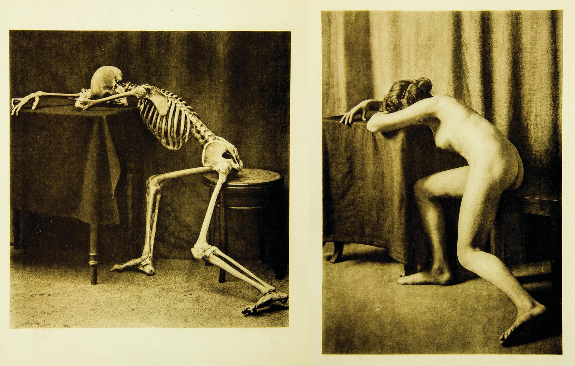 Albert Hasselwander Nude Photograph - Ein Anatomischer Totentanz. 