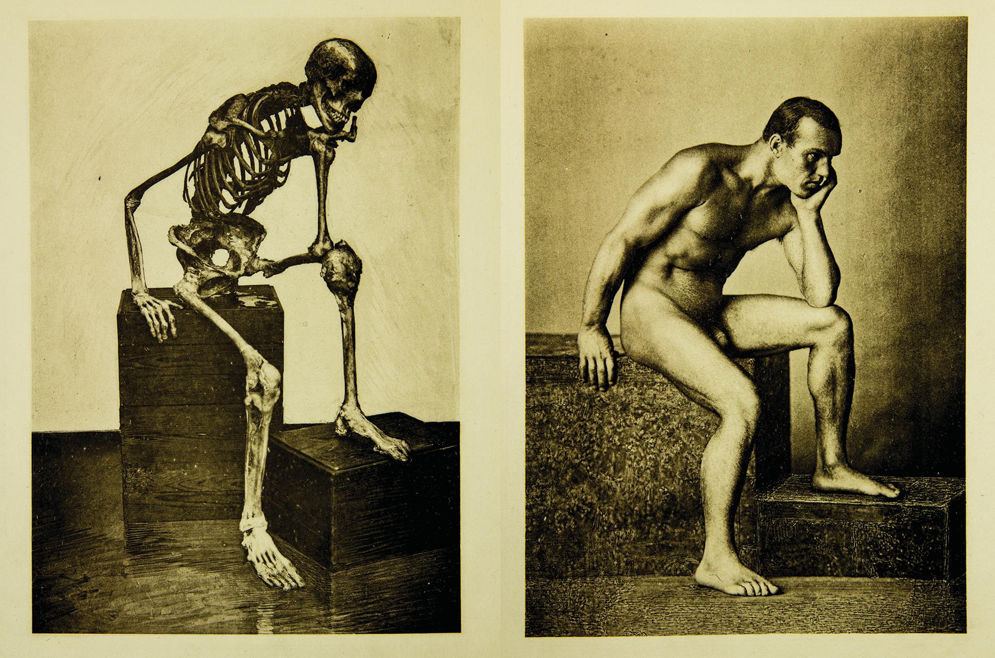 Ein Anatomischer Totentanz.  - Photograph by Albert Hasselwander