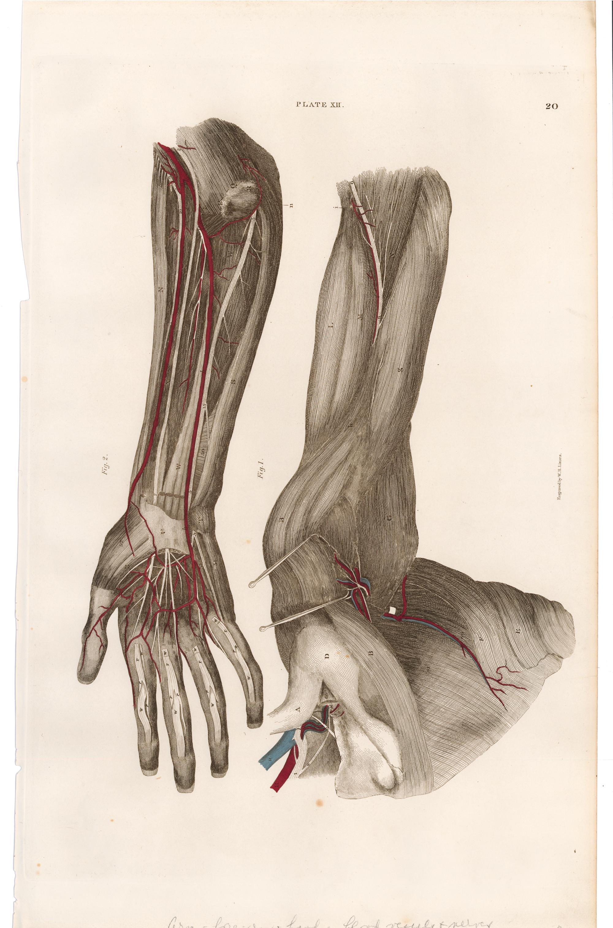 Anatomische Gravur eines menschlichen Arms – Print von John Lizars