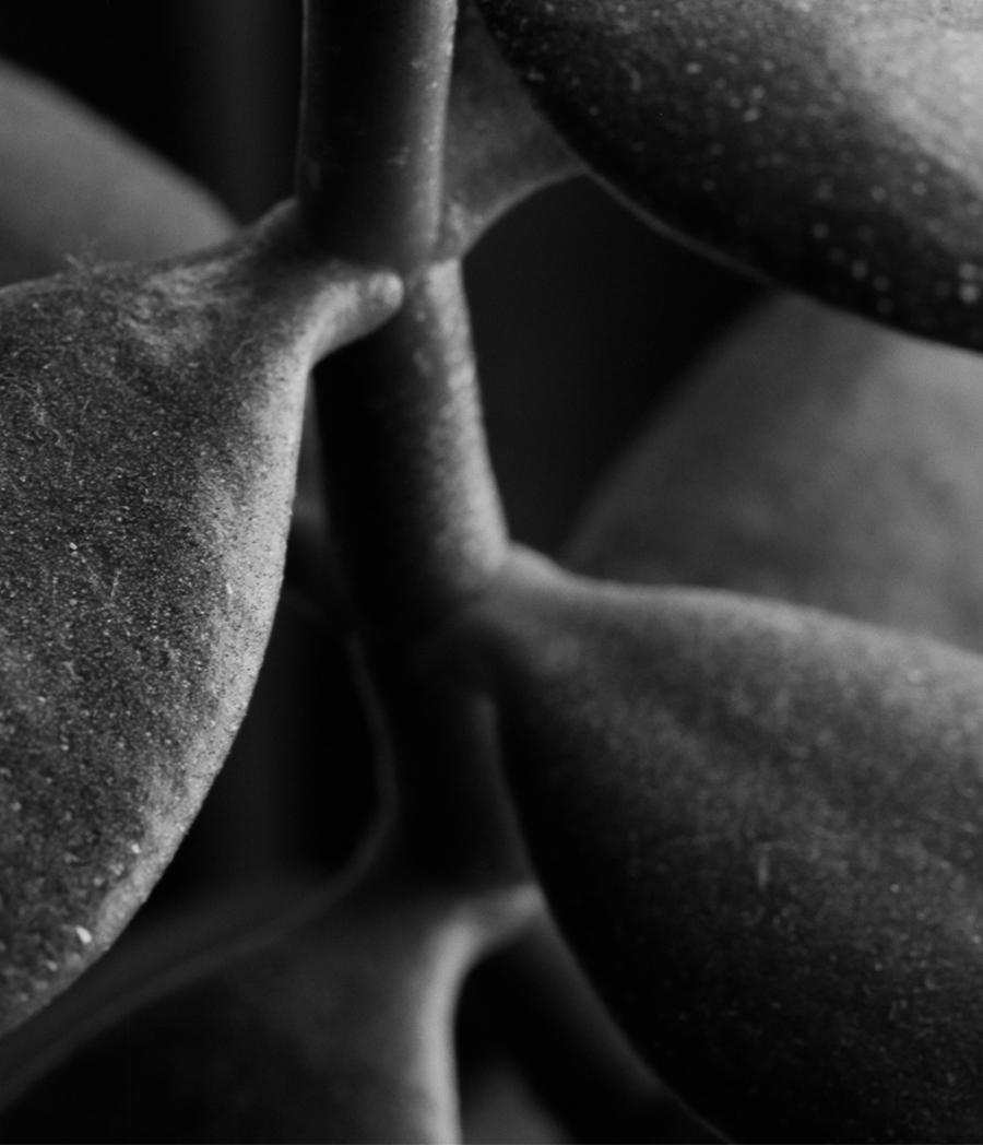 Jade Crassula Ovata, Pigment Print photograph - Black Black and White Photograph by Miguel Winograd 