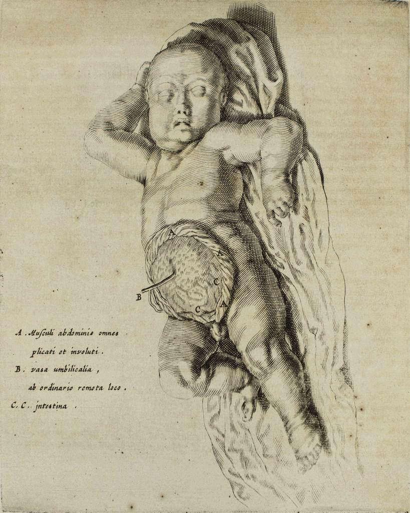 Anatomy of the Child is an original etching realized as plate no. 2 of Andrea Vesalio's "De Humani Corporis Fabrica".  
The "De Humani Corporis Fabrica is commonly considered a major advance in the history of medicine and anatomy in particular, as