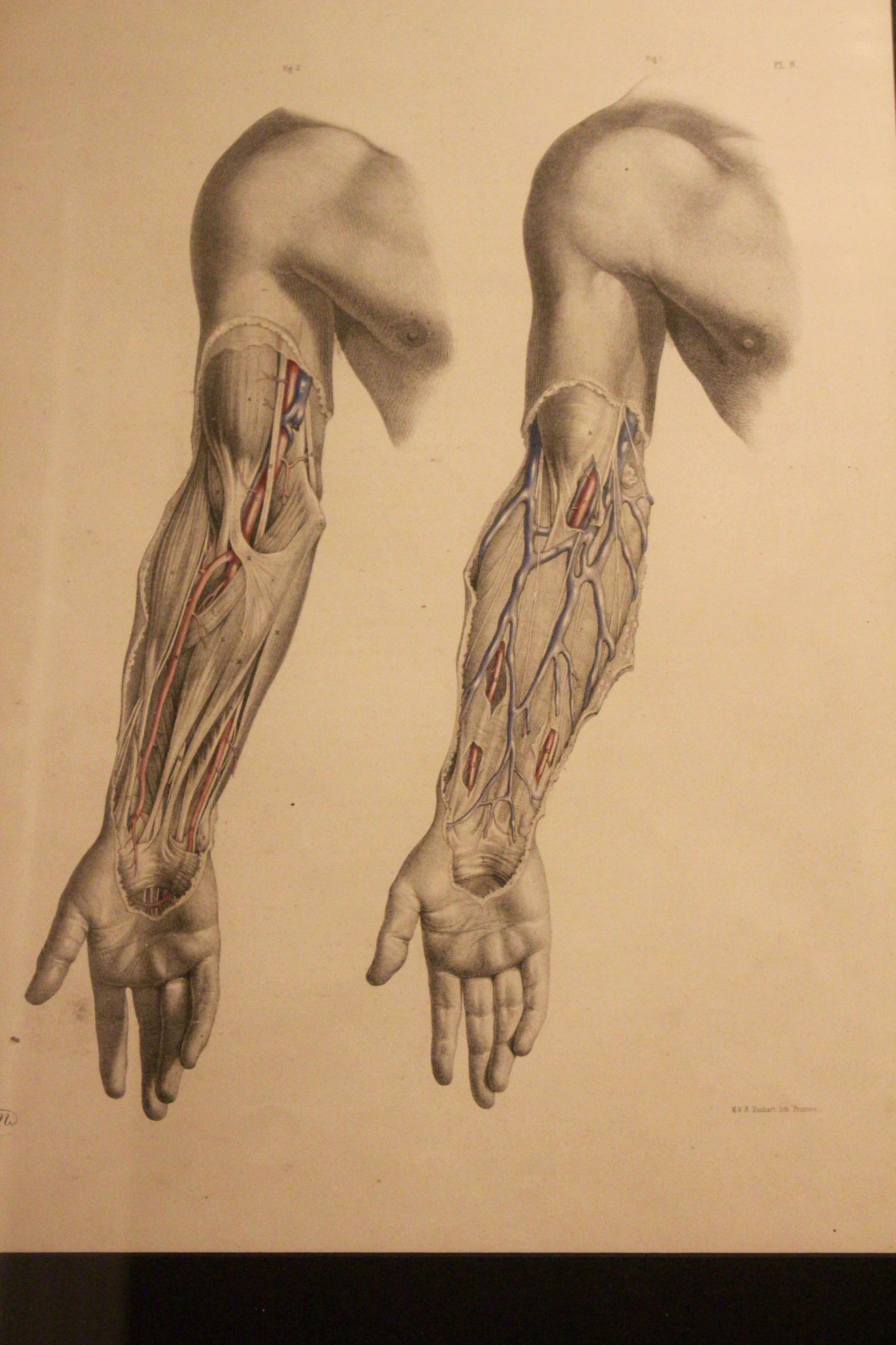 Anatomical Study - Black Nude Print by Joseph Maclise