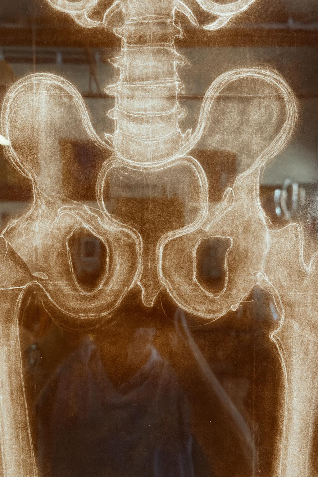 Alain Gerard Clement Silber Gelatine Fotogenes Bild Menschliches Skelett im Angebot 2