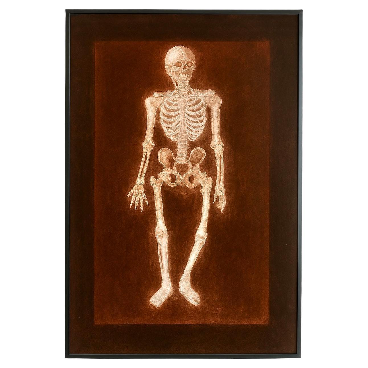 Alain Gerard Clement Silber Gelatine Fotogenes Bild Menschliches Skelett im Angebot