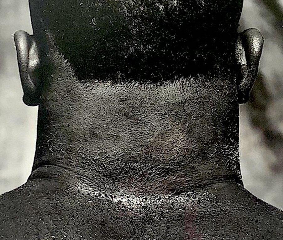 mike tyson neck