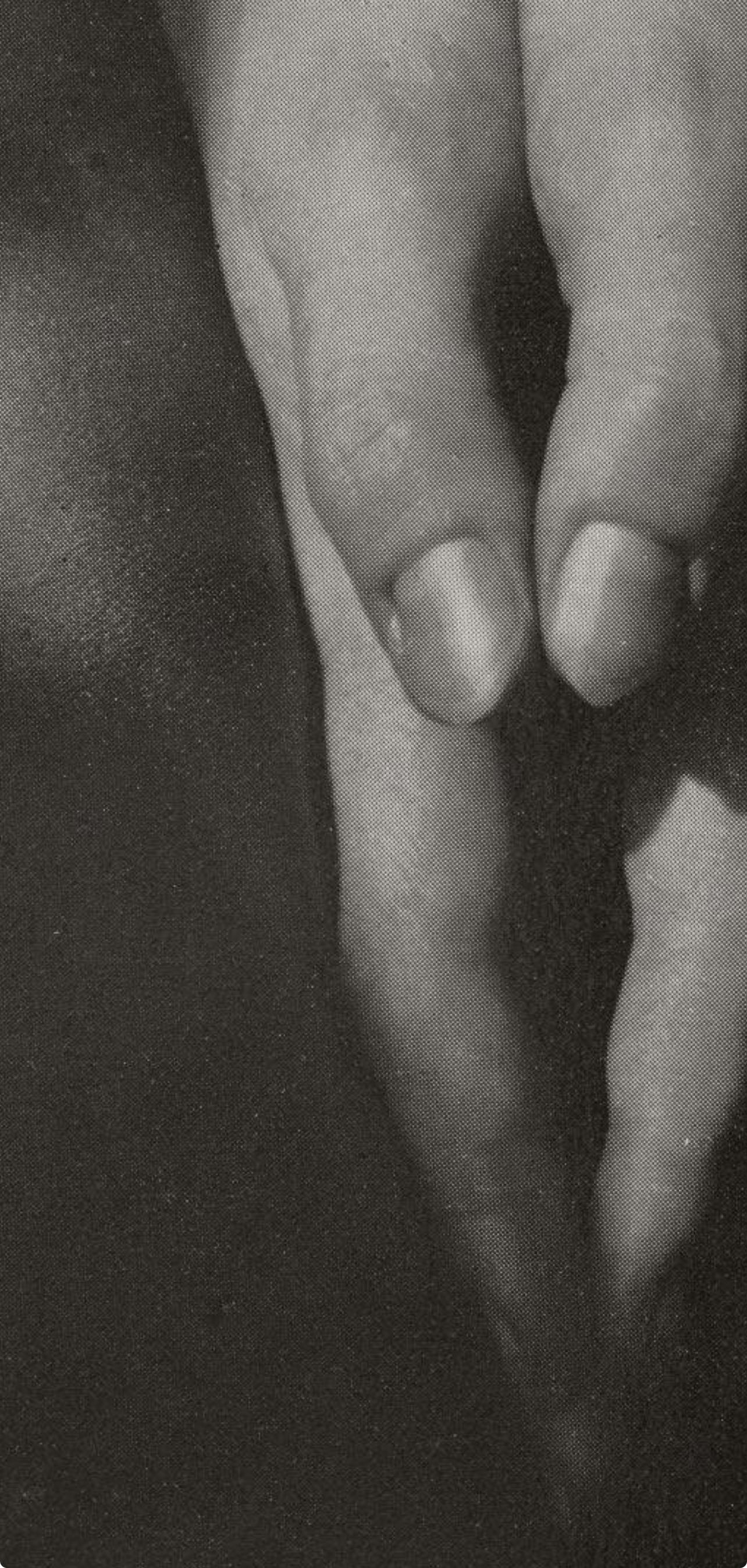 Alfred Stieglitz, Hands, Dorothy Norman, 1947 (after) For Sale 3