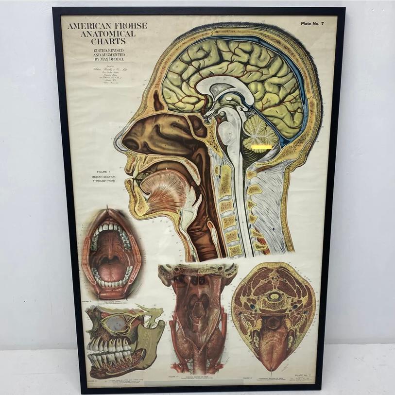 European American Frohse Anatomical Chart  For Sale