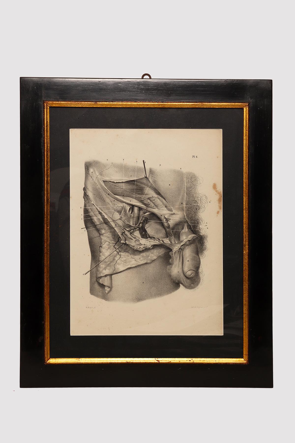 Una stampa litografica anatomica su carta che raffigura il sistema genitale maschile. Struttura in legno di abete laccato nero con battitura in legno di ramin dorato. N. H. H. Jacob, Parigi, metà del XIX secolo.