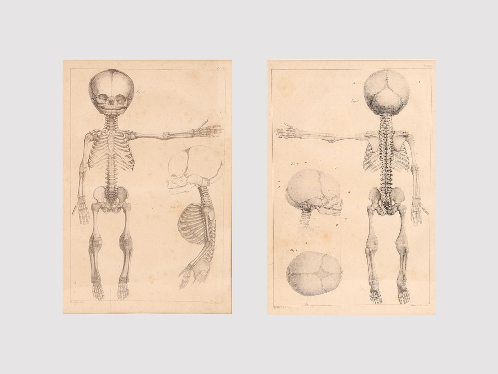 A rare couple of French anatomical lithographs of the fetus skeleton, in a vintage metal frame. Great quality and artistic composition. 
Printed by Charles Motte. Paris early19th century.