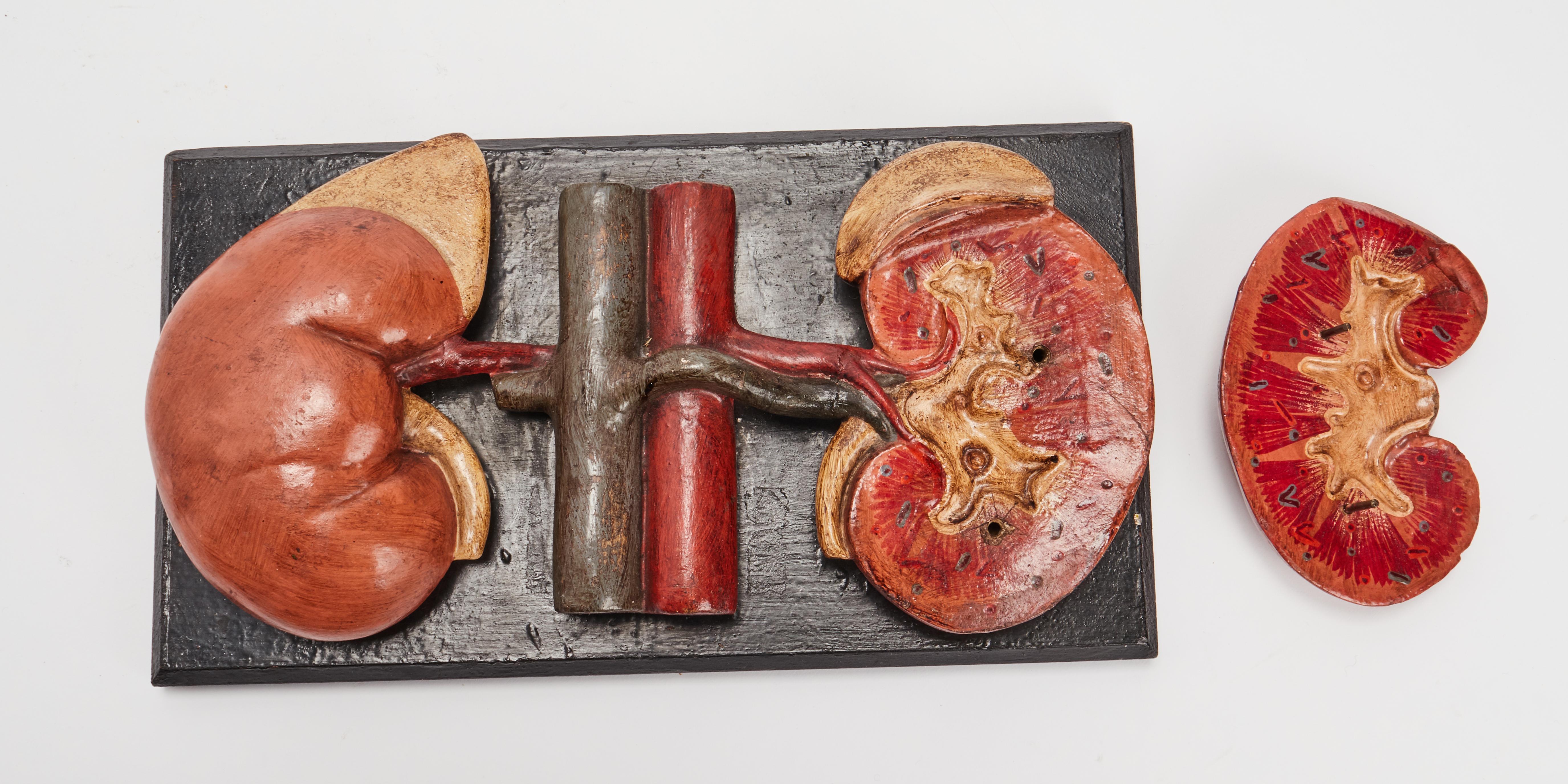 Anatomic model for class, depicting the kidneys, made out of painted papier maché and mounted over a black painted wooden base. Spain circa 1890.