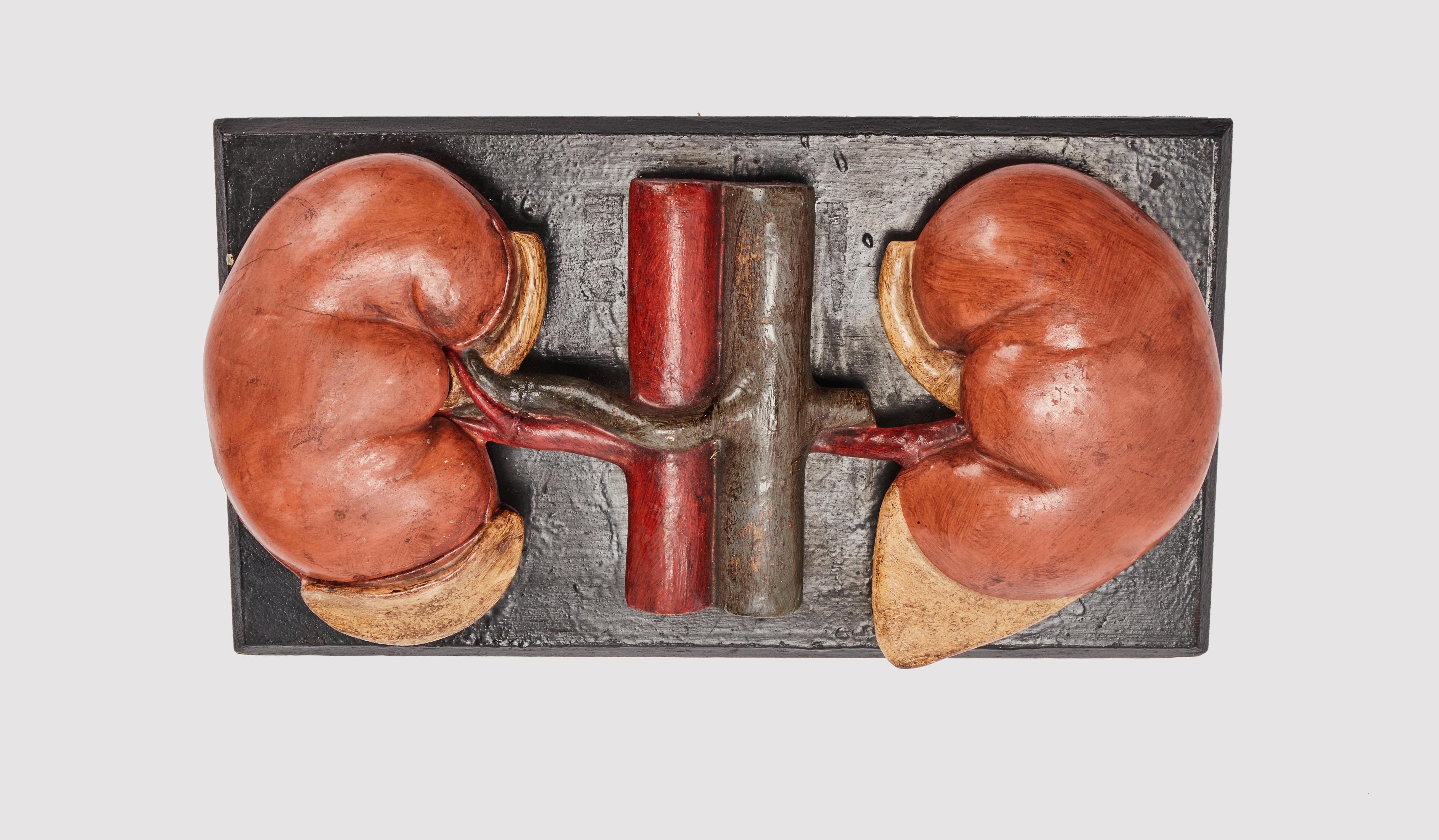 working model of kidney