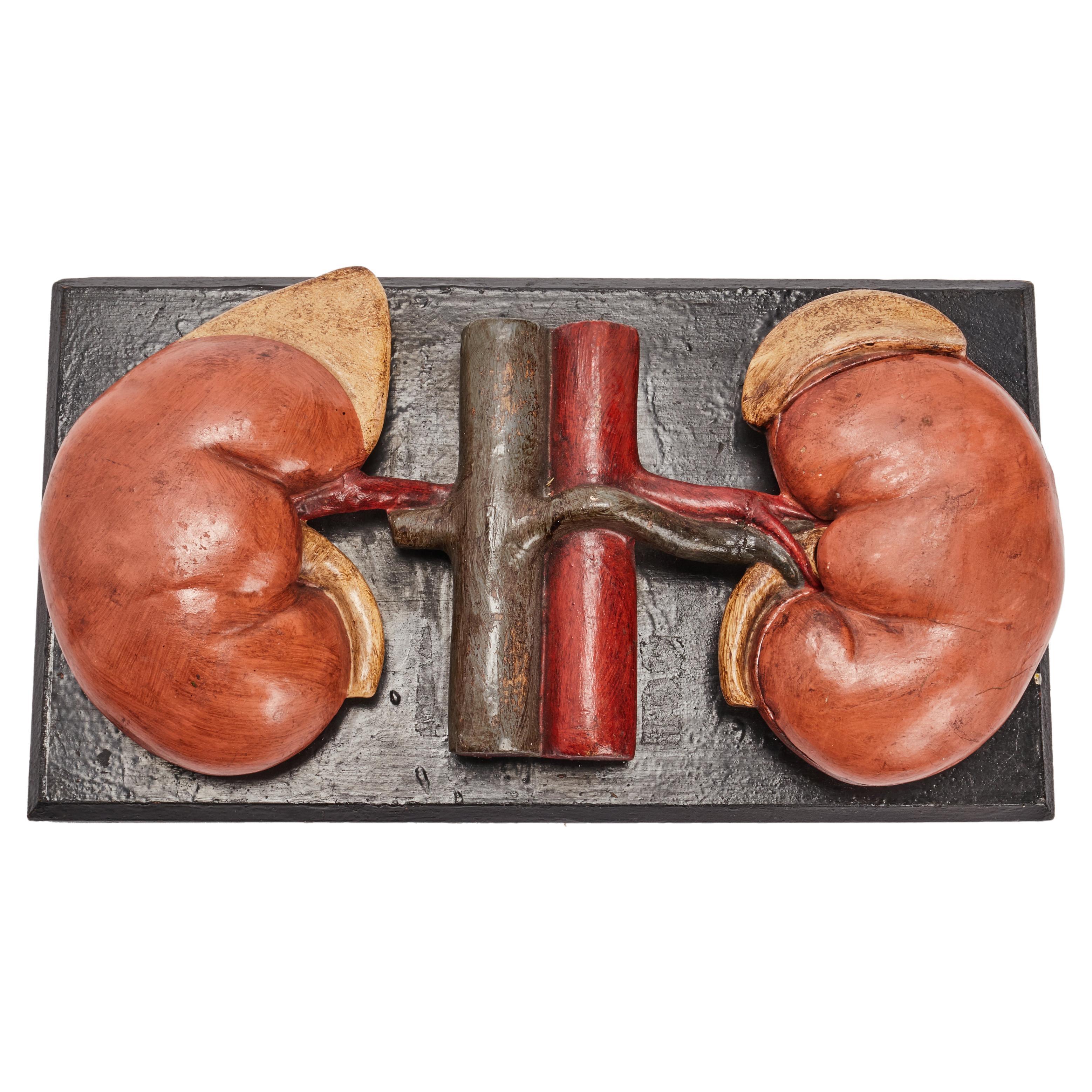 Anatomic Model for Class, Depicting the Kidneys, Spain 1890 For Sale