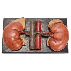 Antique Anatomic Model for Class, Depicting the Kidneys, Spain 1890